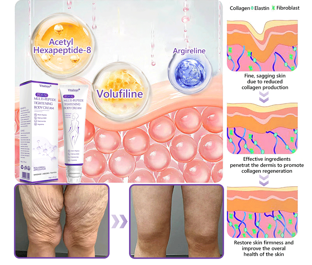FDA Official ✅ : Vitalisys® PDRN Multi-Peptide Massaging Body Roller Cream ✨ - Anti-aging, Hydrating, Skin Firming & Lifting, Skin Repair, Even Tone, Acne and Dark Spot Treatment, Wart and Mole Removal, and Psoriasis Relief 💕