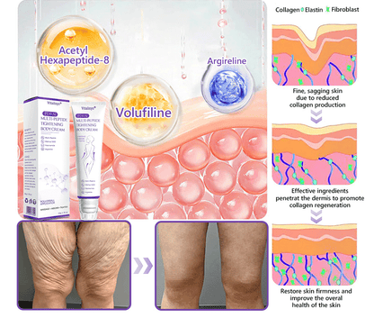FDA Official ✅ : Vitalisys® PDRN Multi-Peptide Massaging Body Roller Cream ✨ - Anti-aging, Hydrating, Skin Firming & Lifting, Skin Repair, Even Tone, Acne and Dark Spot Treatment, Wart and Mole Removal, and Psoriasis Relief 💕