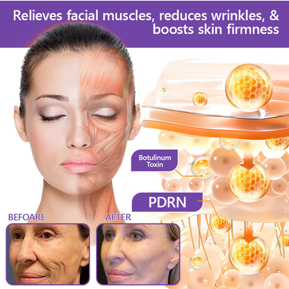 FDA Official ✅ : Vitalisys® PDRN Multi-Peptide Massaging Body Roller Cream ✨ - Anti-aging, Hydrating, Skin Firming & Lifting, Skin Repair, Even Tone, Acne and Dark Spot Treatment, Wart and Mole Removal, and Psoriasis Relief 💕
