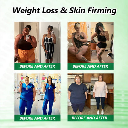 𝑶𝒇𝒇𝒊𝒄𝒊𝒂𝒍 𝒔𝒕𝒐𝒓𝒆  | 🩹𝐌𝐮𝐫𝒘𝒐𝒏® 𝐌𝐨𝐫𝐢𝐧𝒈𝗮 𝑩𝒆𝒓𝒃𝒆𝐫𝐢𝐧𝐞𝐱 𝐍𝗔𝒟+ 10-𝑖n-1 𝐍a𝒏𝒐 𝐌𝐢𝐜𝐫𝑜𝑛𝑒𝑒𝗱𝗹𝗲 𝐏𝐚𝒕𝒄𝒉🇺🇸(𝐉𝐮𝐬𝐭 𝐨𝐧𝐜𝐞 𝐚 𝐝𝐚𝐲, 𝐯𝐢𝐬𝐢𝐛𝐥𝐞 𝐜𝐡𝐚𝐧𝐠𝐞𝐬 𝐢𝐧 𝟕 𝑫𝐚𝐲𝐬） ✅ 𝐅𝐨𝐫 𝐎𝐛𝐞𝐬𝐢𝐭𝐲,  𝙇𝙊𝙊𝙎𝗘 𝗦𝗞𝗜𝗡,𝐝𝐢𝐚𝐛𝐞𝐭𝙚𝙨, 𝐬𝐥𝐞𝐞𝐏 𝐚𝐩𝐧𝐞𝐚, 𝐣𝐨𝐢𝐧𝐭 𝐢𝐬𝐬𝐮𝙚𝙨, 𝐚𝐧𝐝 𝐦𝐨𝐫𝐞