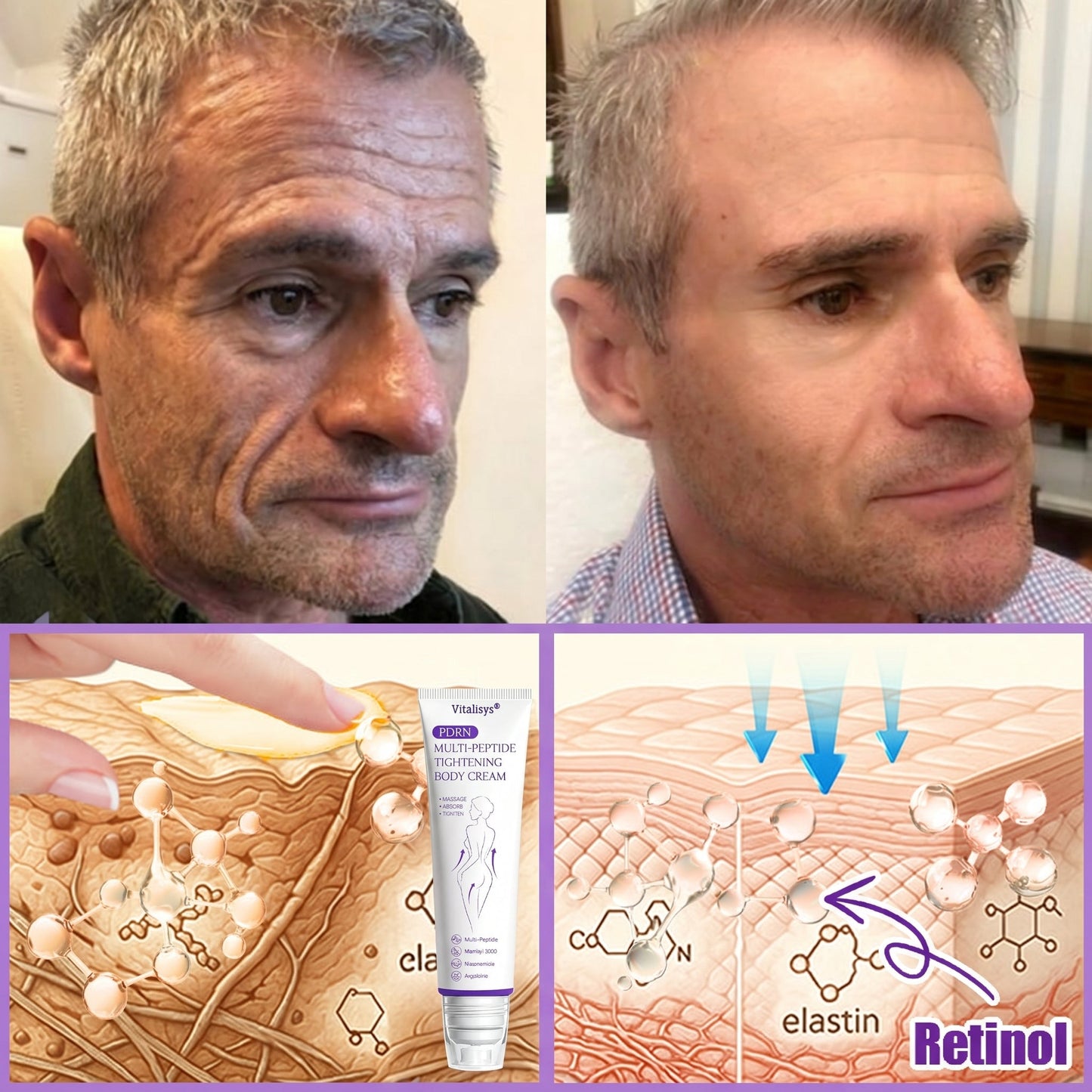 FDA Official ✅ : Vitalisys® PDRN Multi-Peptide Massaging Body Roller Cream ✨ - Anti-aging, Hydrating, Skin Firming & Lifting, Skin Repair, Even Tone, Acne and Dark Spot Treatment, Wart and Mole Removal, and Psoriasis Relief 💕